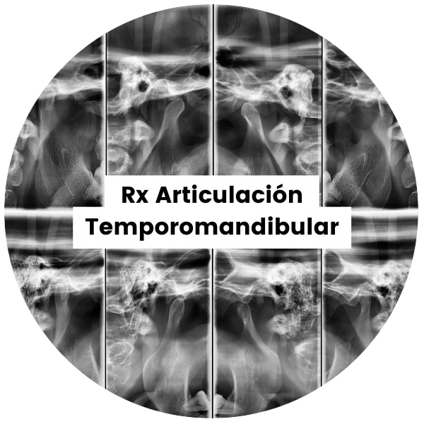 1-RxATM