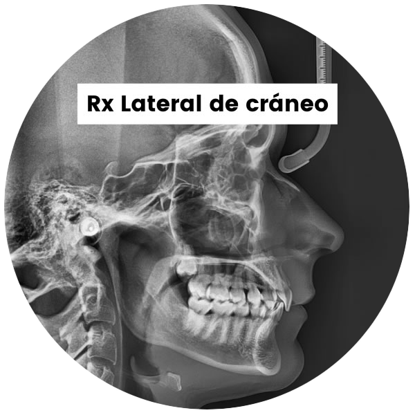 1-RxLateralCraneo