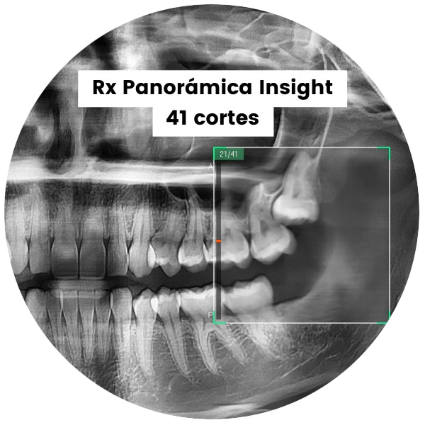 Rx Panoramica Insight