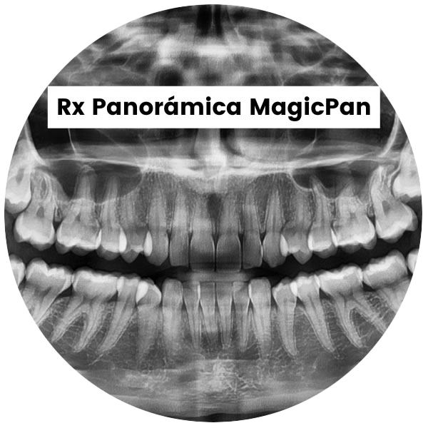 RxPanoramicaMagicPan