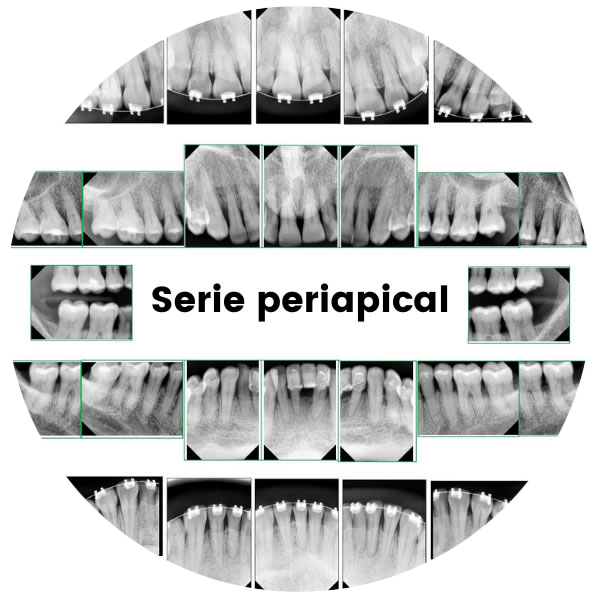 Serie Periapical