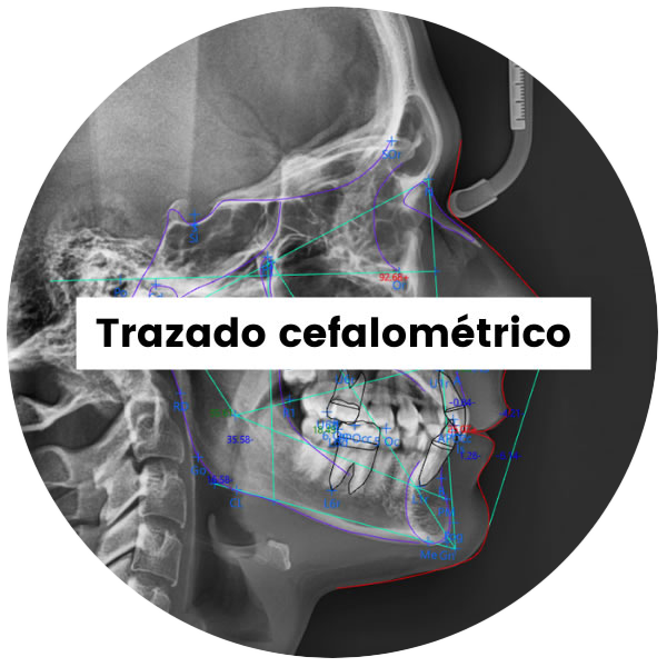 1-TrazadoCefalometrico