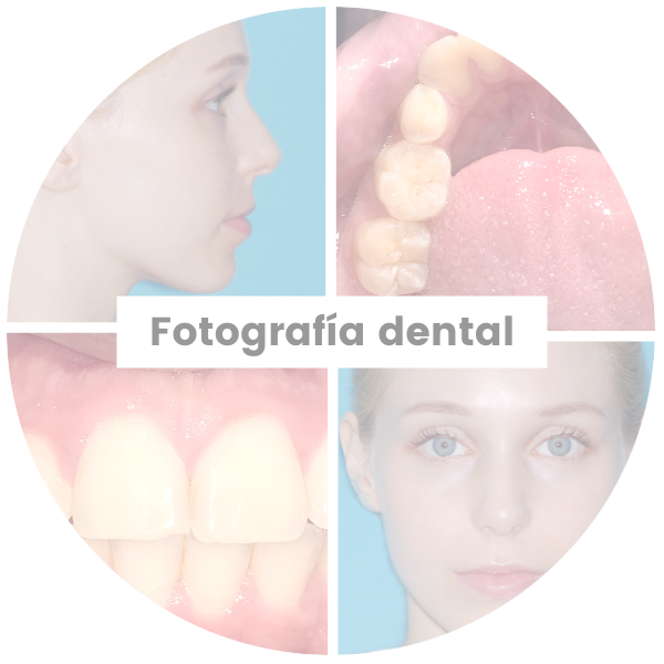 Fotografia Dental