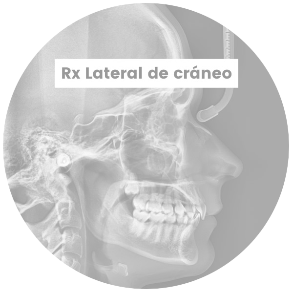 2-RxLateralCraneo