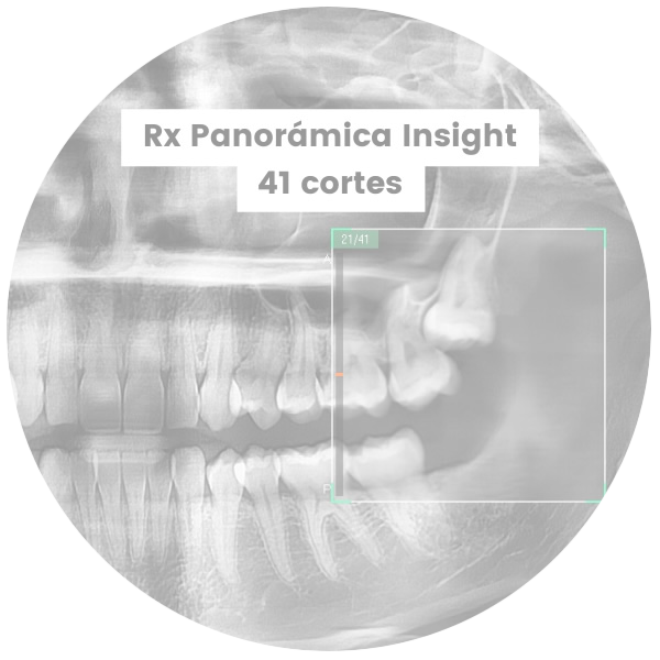 Rx Panoramica Insight