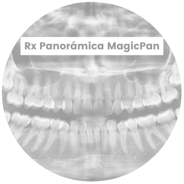 2-RxPanoramicaMagicPan