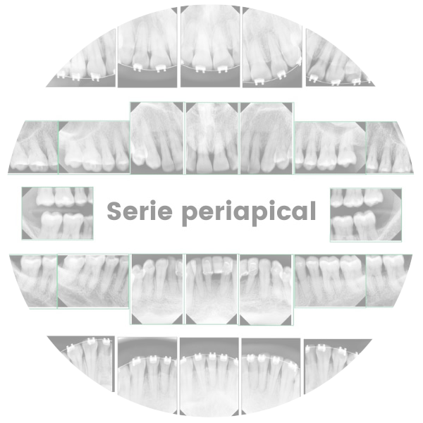 Serie Periapical