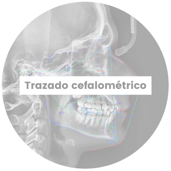 2-TrazadoCefalometrico