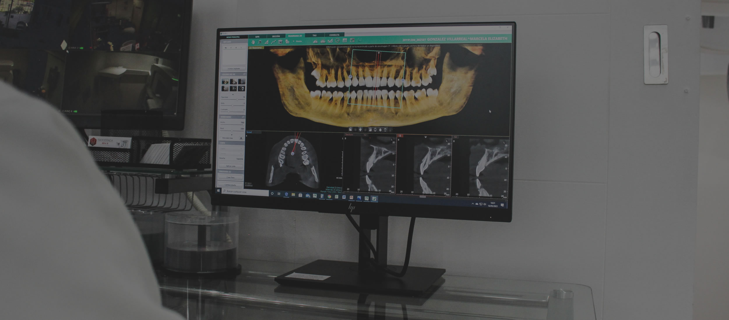 radiologia digital 3d