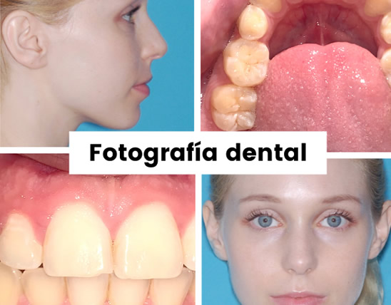 fotografía dental