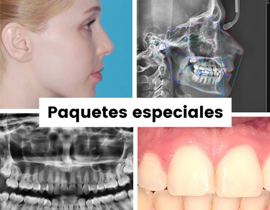 paquetes-especiales