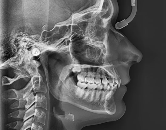 rx craneo lateral