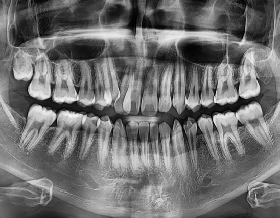 rx-panoramica-magicpan1